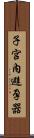 子宮內避孕器 Scroll