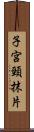 子宮頸抹片 Scroll