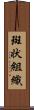 斑状組織 Scroll