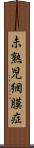 未熟児網膜症 Scroll
