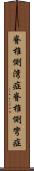 脊椎側湾症 Scroll