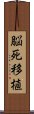 脳死移植 Scroll