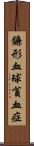 鐮形血球貧血症 Scroll