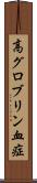 高グロブリン血症 Scroll