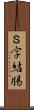 Ｓ字結腸 Scroll