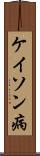 ケイソン病 Scroll