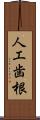 人工歯根 Scroll