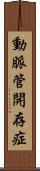 動脈管開存症 Scroll