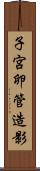 子宮卵管造影 Scroll