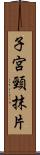 子宮頸抹片 Scroll