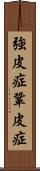 強皮症 Scroll