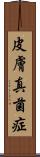 皮膚真菌症 Scroll