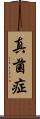 真菌症 Scroll