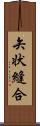 矢状縫合 Scroll
