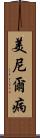 美尼爾病 Scroll