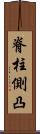 脊柱側凸 Scroll