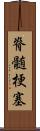 脊髄梗塞 Scroll
