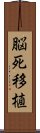 脳死移植 Scroll