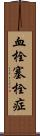 血栓塞栓症 Scroll