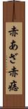 赤あざ Scroll