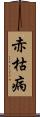赤枯病 Scroll