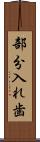 部分入れ歯 Scroll