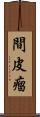 間皮瘤 Scroll