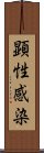 顕性感染 Scroll