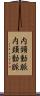 内頸動脈 Scroll