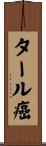 タール癌 Scroll