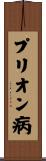 プリオン病 Scroll