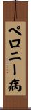 ペロニー病 Scroll
