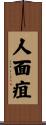 人面疽 Scroll