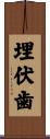 埋伏歯 Scroll