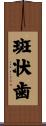 斑状歯 Scroll