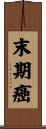 末期癌 Scroll