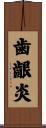歯齦炎 Scroll