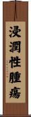 浸潤性腫瘍 Scroll