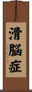 滑脳症 Scroll