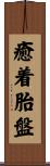 癒着胎盤 Scroll
