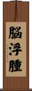 脳浮腫 Scroll