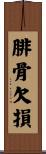 腓骨欠損 Scroll