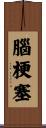 腦梗塞 Scroll