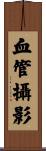 血管攝影 Scroll