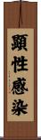 顕性感染 Scroll