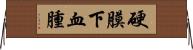 硬膜下血腫 Horizontal Wall Scroll