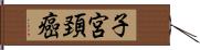 子宮頚癌 Hand Scroll