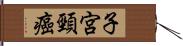 子宮頸癌 Hand Scroll