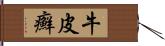 牛皮癬 Hand Scroll