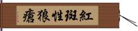 紅斑性狼瘡 Hand Scroll